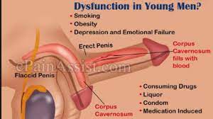 Erection Dysfunction