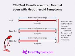 Tsh Test Results Are Often Normal Even With Hypothyroid