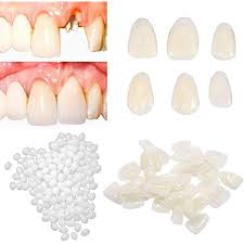 How do diy veneer teeth work? Amazon Com Temporary Tooth Repair Kit Teeth Veneers For Fix The Missing Tooth Teaching Thermal Fitting Beads For Filling The Broken Tooth And Teeth Gap Resin Fake Teeth Crown Beauty