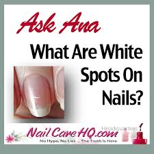 ask ana white spots on nails nail