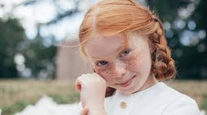freckled redheads some body parts