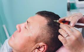 prp treatments in toronto prp hair