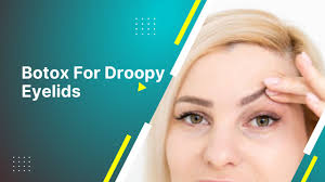 botox for droopy eyelids 2024