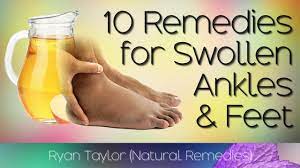 10 home remes for swollen feet and