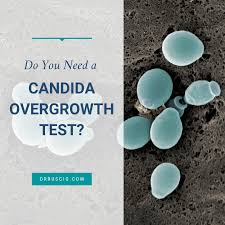 do you need a candida overgrowth test