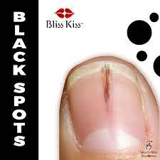 black spots in nails bliss kiss by