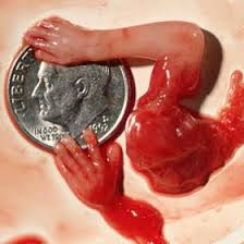 Image result for aborted babies