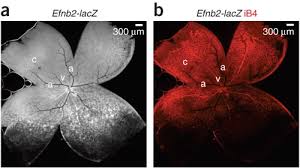Every place in the world has their own kind of look some i've never seen before so i need my flower book. Inducible Gene Targeting In The Neonatal Vasculature And Analysis Of Retinal Angiogenesis In Mice Nature Protocols