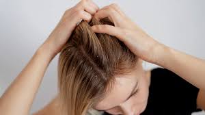 causes of itchy scalp and tips to treat
