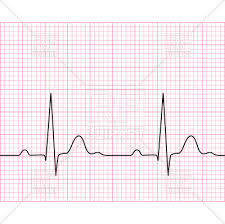 Medical Electrocardiogram Ecg On Chart Paper Stock Vector Image