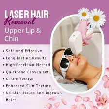 laser hair removal for the upper lip