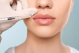 all about lip fillers at arteca in