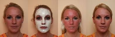 brown spots and agespots treatment in