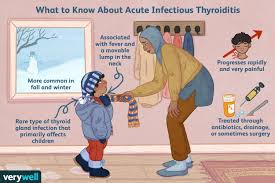 acute infectious thyroiditis symptoms