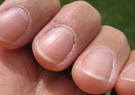 what nails tell you about your health