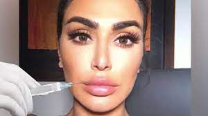 must read why removing my lip filler