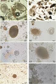 Different Parasite Stages In Tortoises Faecal Samples With