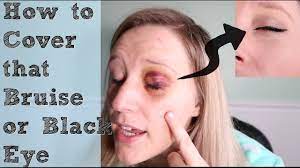 how to cover a black eye you