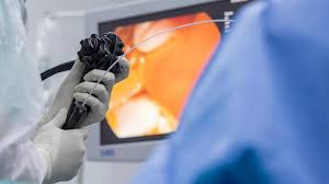 what can you expect from a laparoscopic