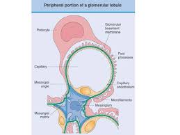 Nephrotic Syndrome 04 03 15 Flashcards