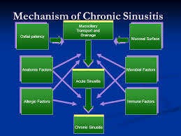 Current Concepts In The Management Of Chronic Sinusitis