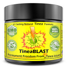 tinea versicolor treatment cream fast