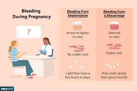 implantation bleeding vs miscarriage