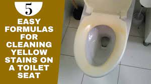 cleaning yellow stains on a toilet seat