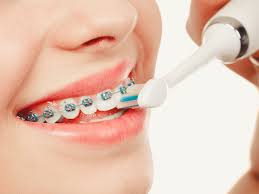 An orthodontic floss threader is an inexpensive and disposable tool available in most stores that sell toothbrushes and toothpaste. Brushing And Flossing With Braces Gulf Coast Orthodontics