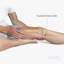7 causes of knee locking when to see