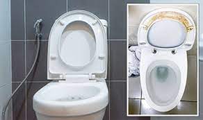 How To Remove Yellow Toilet Seat Stains