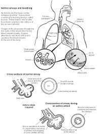 Pathophysiology Of Asthma Diagram Pathophysiology Of Asthma