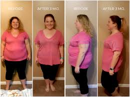 gastric sleeve before and after 3