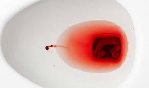 Blood in the stool can be frightening, whether you discover it while wiping after a bowel movement or from a test ordered by blood in stool means there is bleeding somewhere in your digestive tract. Bowel Cancer Symptoms Do You Have Bloody Poo It Could Be A Sign Of The Disease Express Co Uk