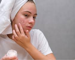 acne and s osler health international