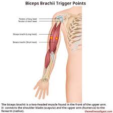 biceps brachii muscle pain the