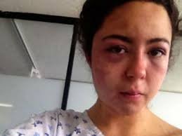 Carmen Pizano, periodista. La joven agredida decidió hacer público su caso después de que las autoridades liberaron a su agresor - 1997528_n_vir1