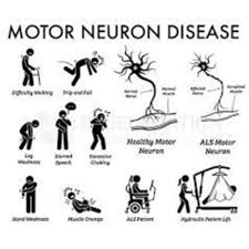 motor neuron diseases treatment at best