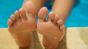 facts about athlete s foot causes