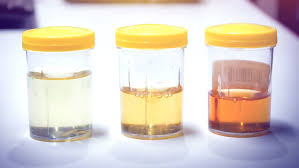 what urine color says about your health