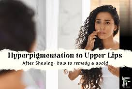 causes of hyperpigmentation after