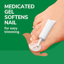 ingrown toenail treatment pain relief