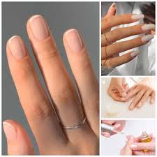what causes brittle nails and what