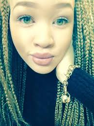 Image result for beautiful albinos