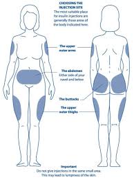 Diagram Showing The Areas Of The Body Most Suitable For