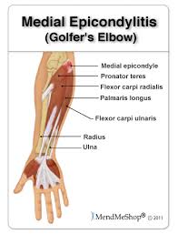 golfers elbow causes