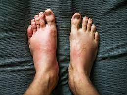 swelling is it serious symptoms