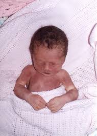 Image result for dead baby on gurney