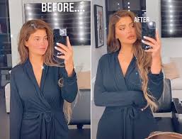 Nose job, lip surgery, chin implants, and jaw surgery. Kylie Jenner Shares Shocking Before And After Makeup Free Pics