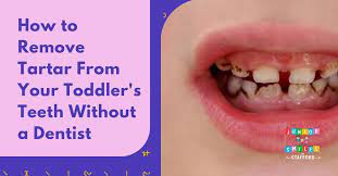 remove tartar from your toddler s teeth